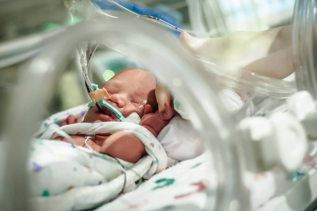 19213031_10100209561999554_1316892285_o